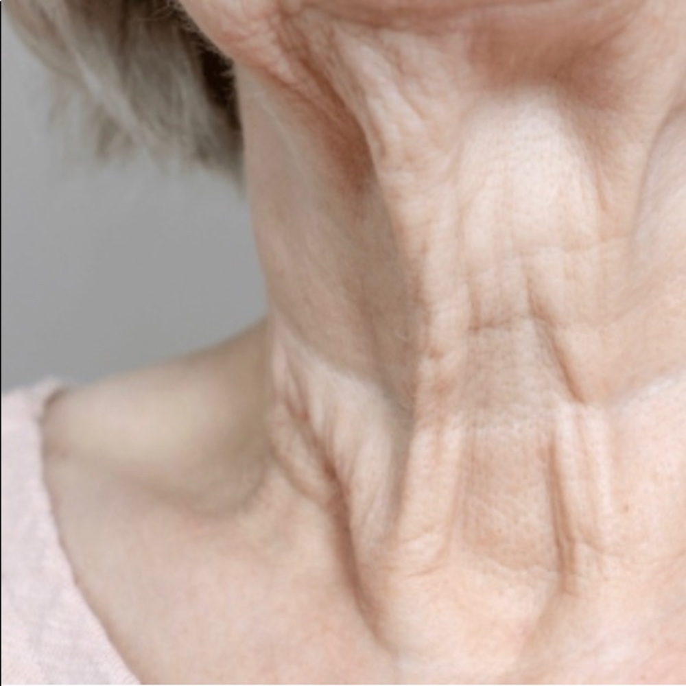 Skin options - Picture 5 of 5